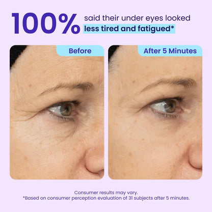 Final 3 Hours: 60%OFF🔥 Instant Lift Eye Gel for Puffiness, Bags & Dark Circles