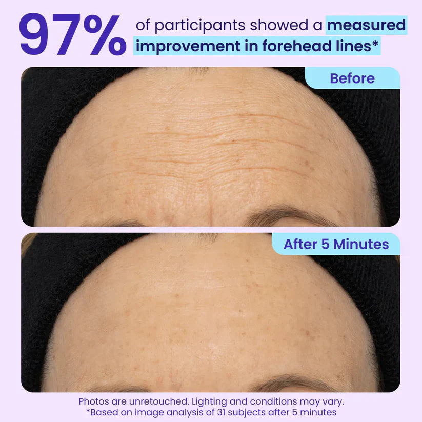 Final 3 Hours: 60%OFF🔥 Instant Lift Eye Gel for Puffiness, Bags & Dark Circles